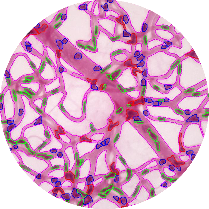 Acellular Capillaries